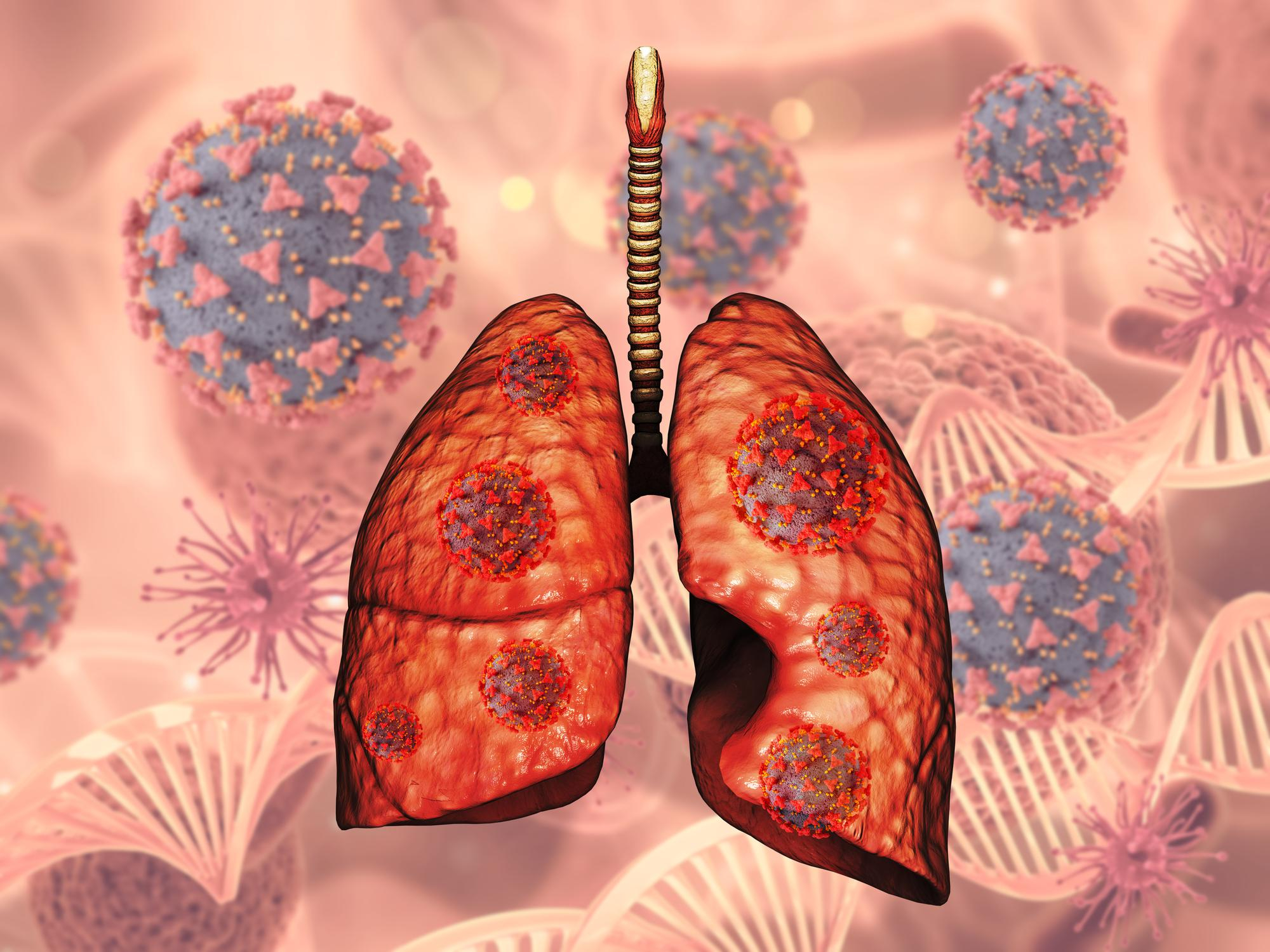 detailed information on lung cancer