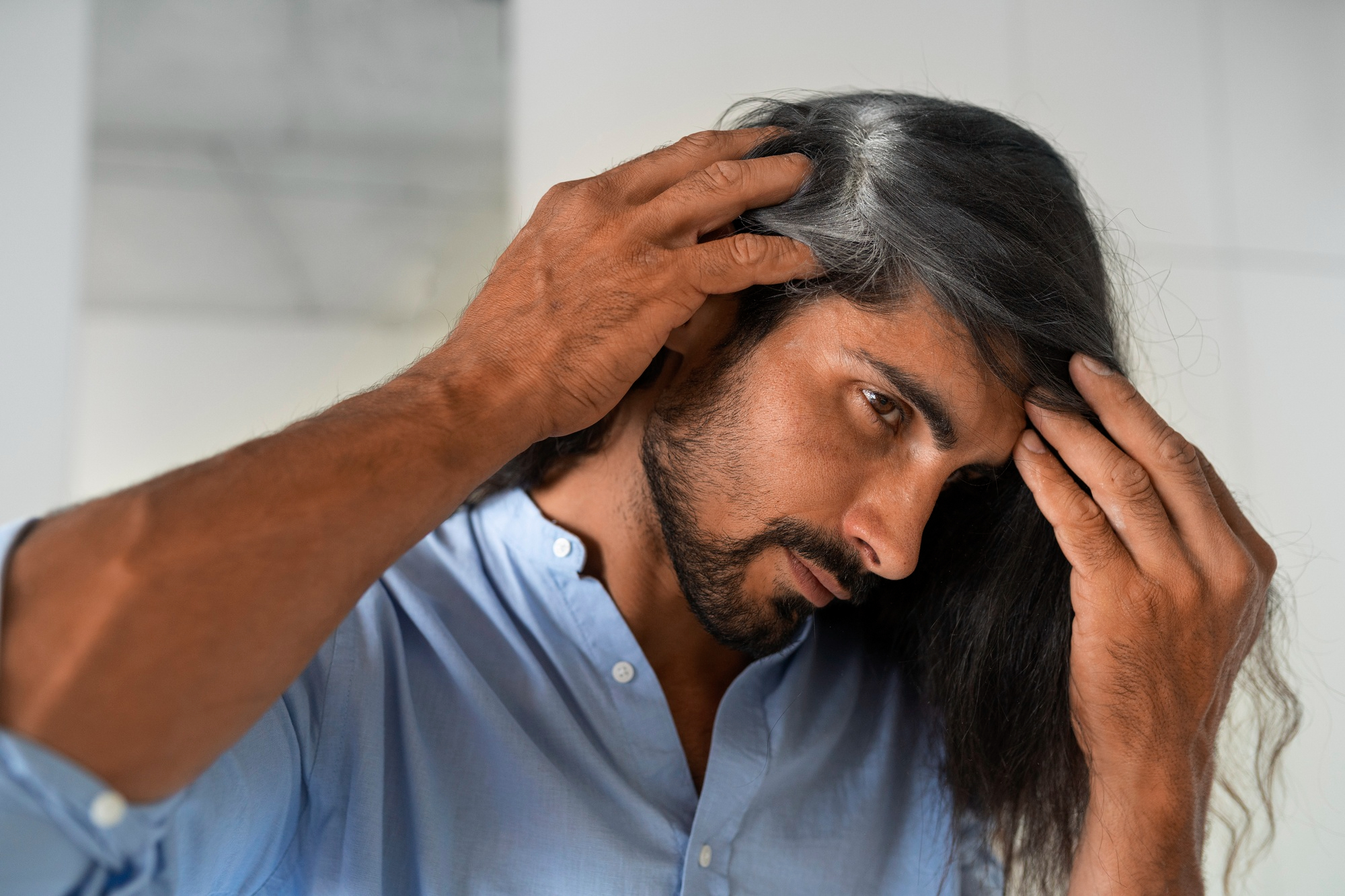 hair loss traditional treatments