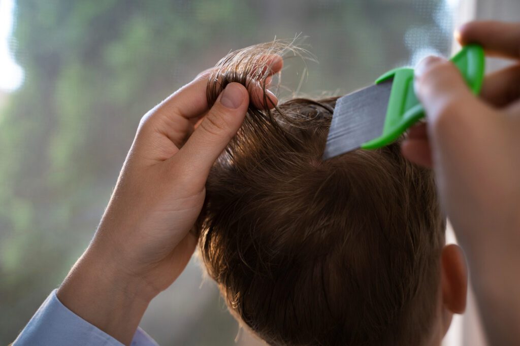 hair loss traditional treatments